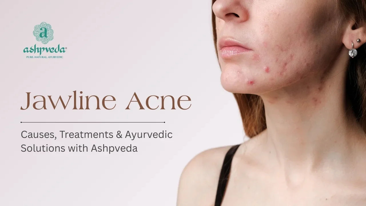 Jawline Acne - Ashpveda