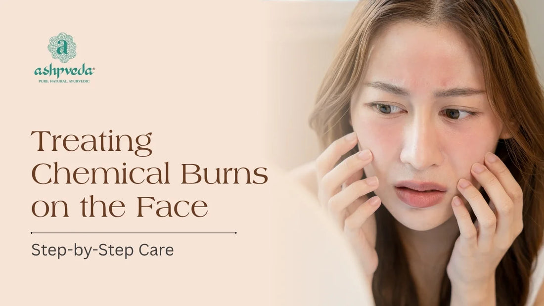 Treating Chemical Burns on the Face