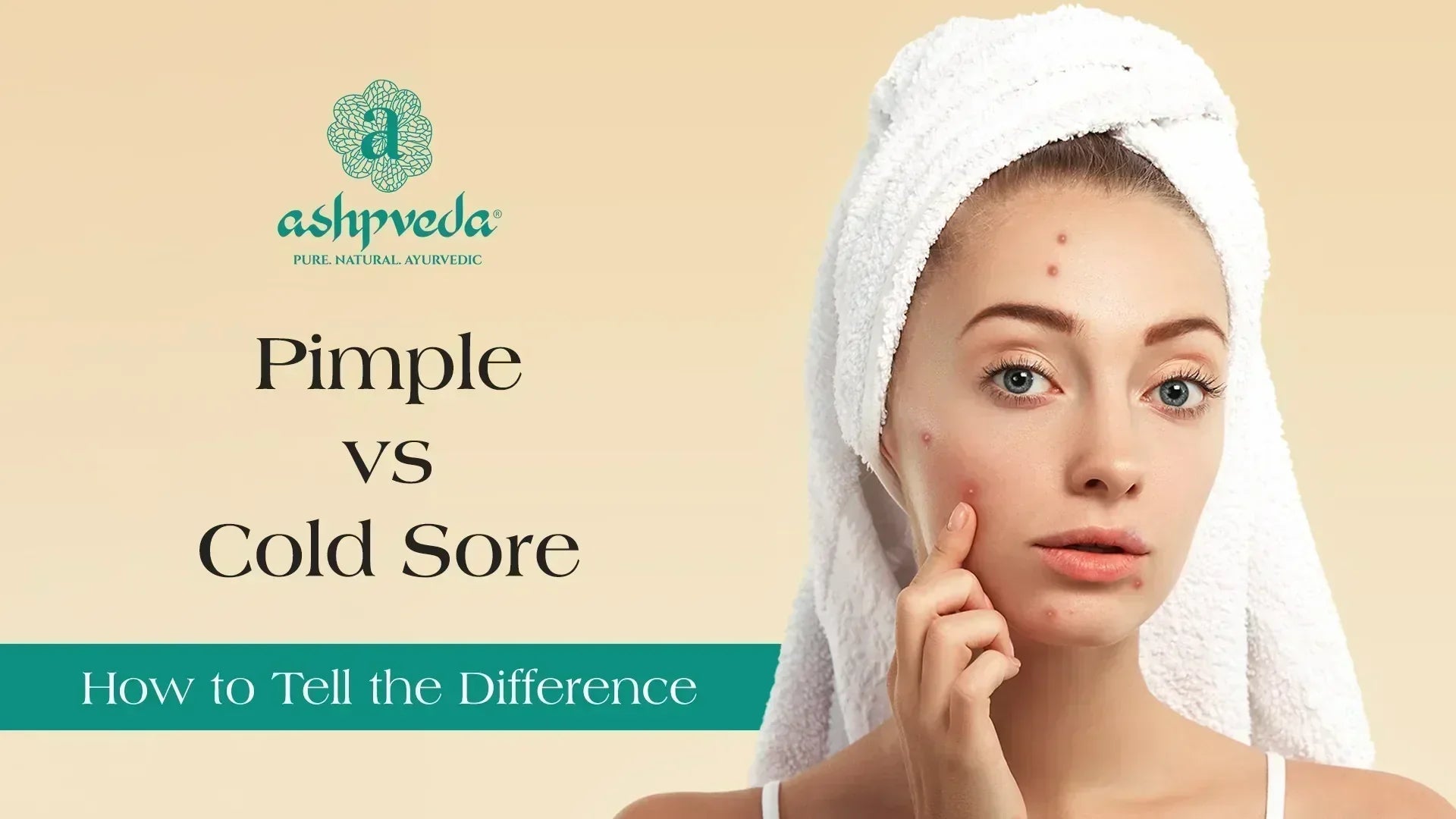 cold sore vs pimple - Ashpveda