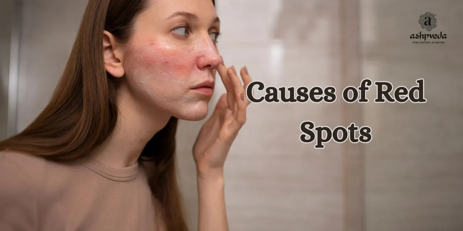 Causes of Red Spots On Skin - Ashpveda