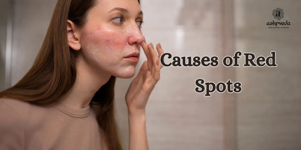 9 Common Causes of Red Spots On The Skin