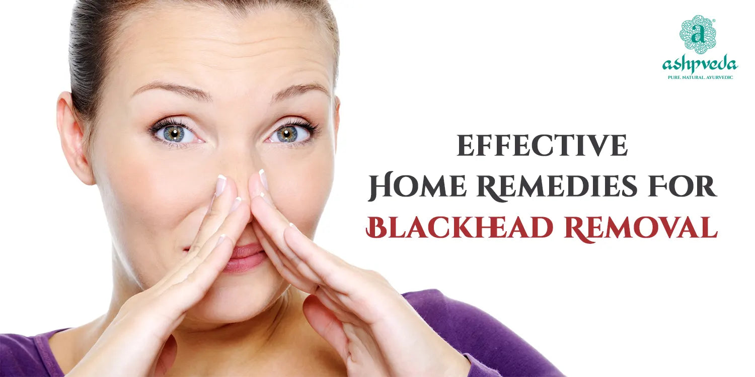 Effective Home Remedies For Blackhead Removal - Ashpveda