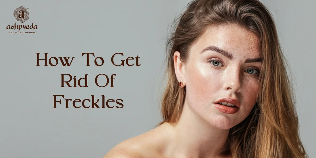 How To Get Rid of Freckles - Ashpveda