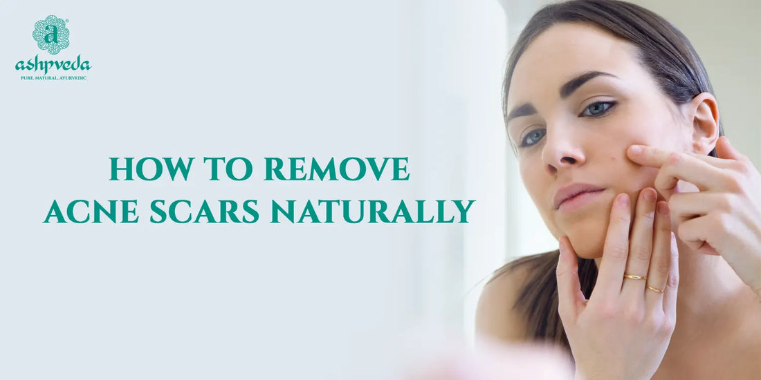 How To Remove Acne Scars Naturally - Ashpveda
