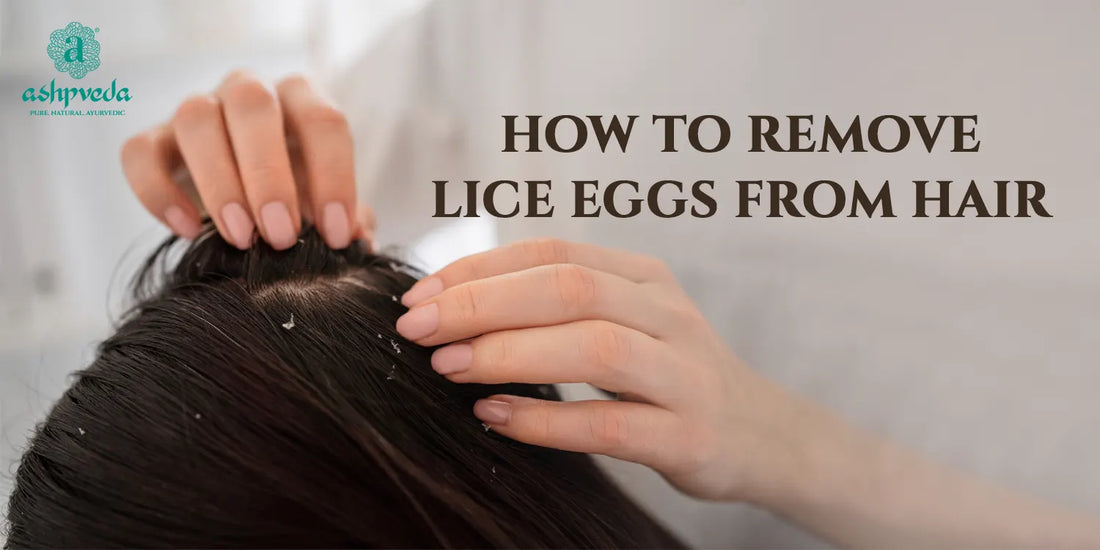 How To Remove Lice Eggs From Hair - Ashpveda