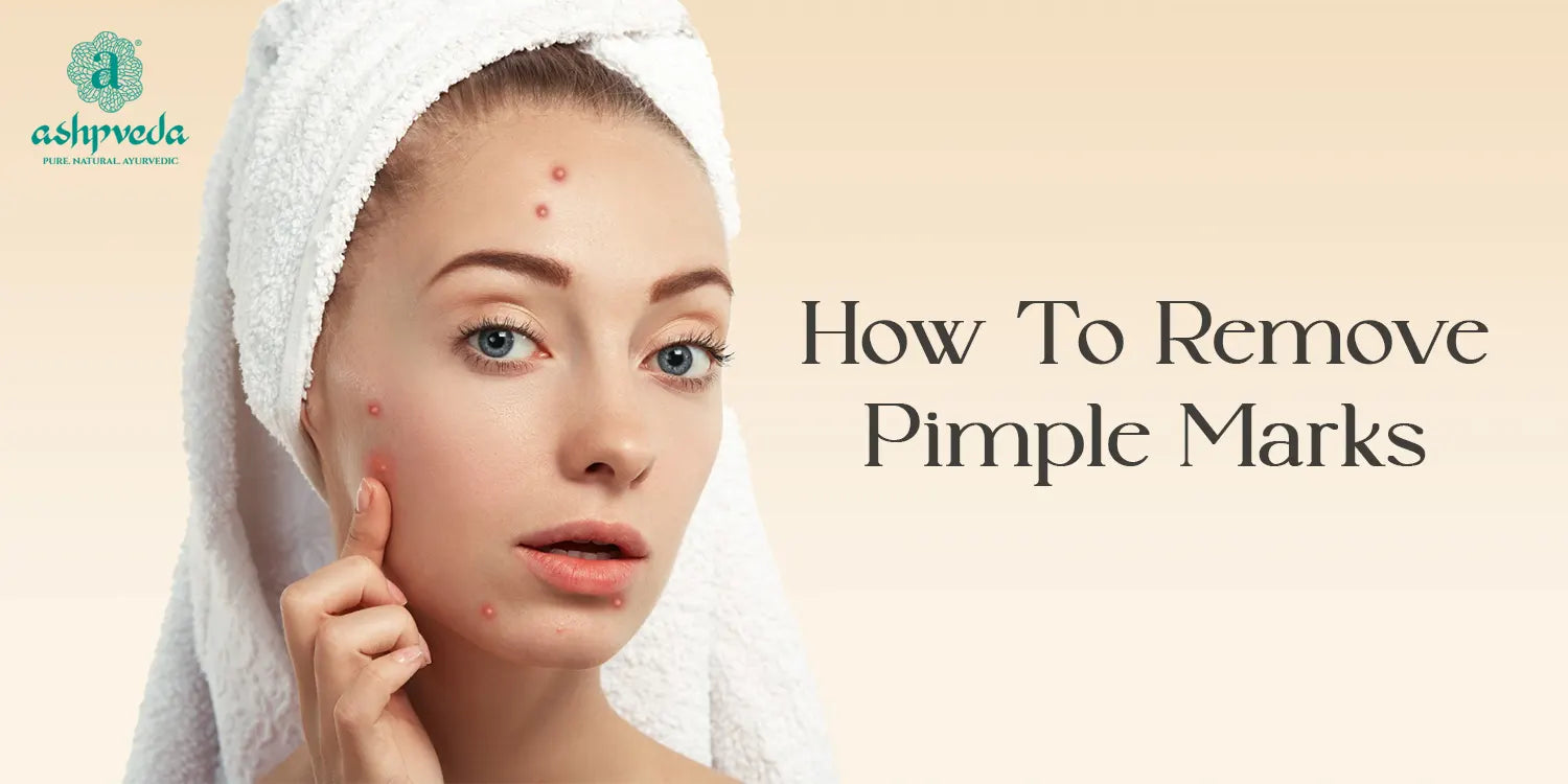 How To Remove Pimple Marks