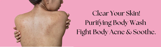 Body Acne (B&B)-N